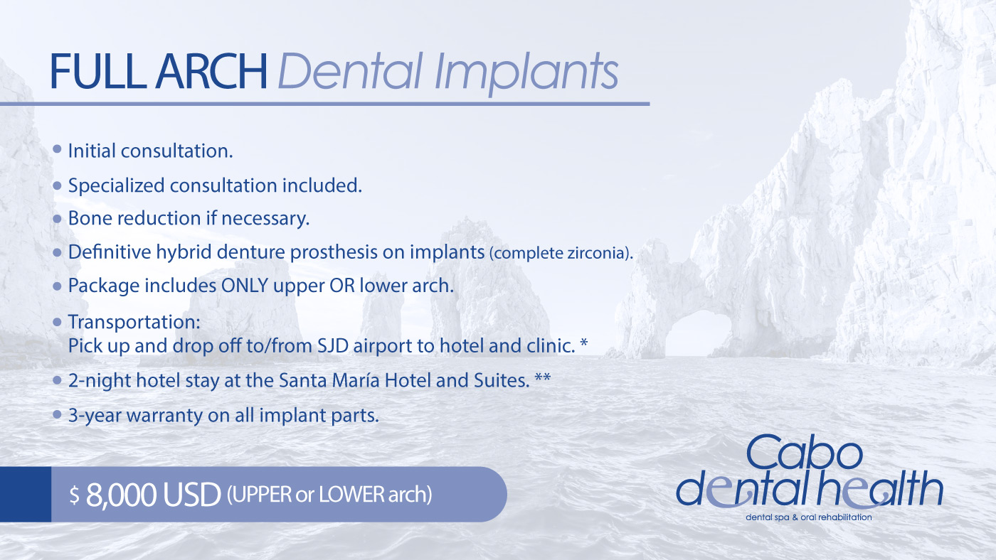 Full Arch Implants